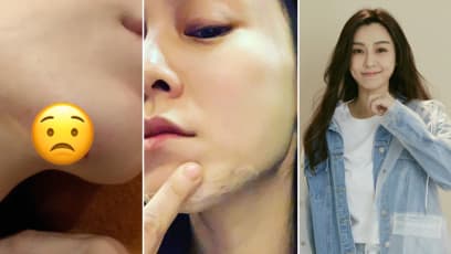 Christine Fan Split Her Chin Open After Falling Down At Home And The Pics Are Too Much