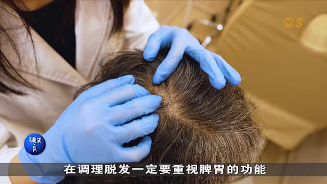 狮城有约 | 脱发有救吗？植发不是一劳永逸？