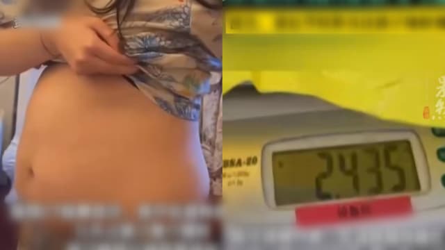 试裤子被店员提醒肚子异常大 中国少女查出恶性肿瘤