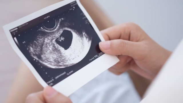 泰乌隆他尼府最年幼怀孕个案 涉及9岁女童与13岁男孩