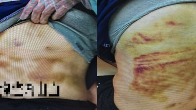 用擀面杖暴打妻子致重伤 台男被判四年监禁