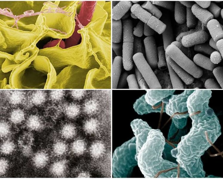 Spize food poisoning: 6 types of pathogens found