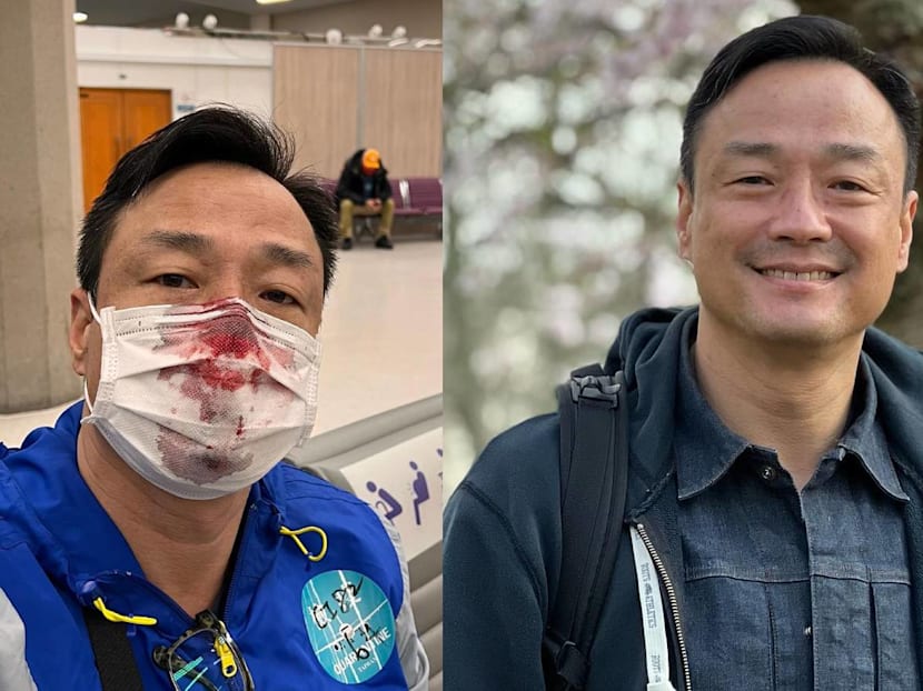 HK Actor Wong Hei Suffers Horrifying Nosebleed After Getting &ldquo;Stabbed&rdquo; In The Nose By Staff Administering His PCR Test At Taiwan Airport