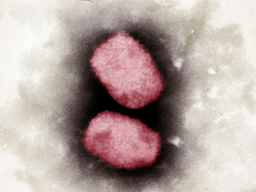 Monkeypox: MOH reaching out to &lsquo;at-risk population&rsquo;, including those engaging in high-risk sexual activities