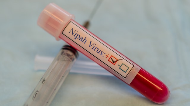 促新加坡民众放心 王乙康：我国有足够机制应对立百