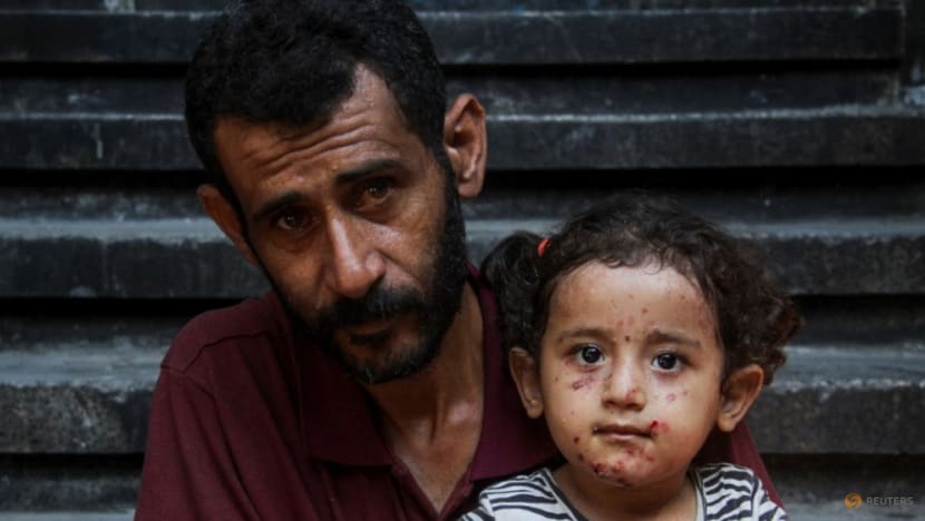 Skin diseases afflict Gaza's children as war drags on without end Skin diseases afflict Gaza's children as war drags on without end