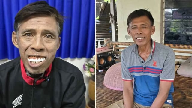 泰阿叔网购假牙 竟收到玩具假牙 