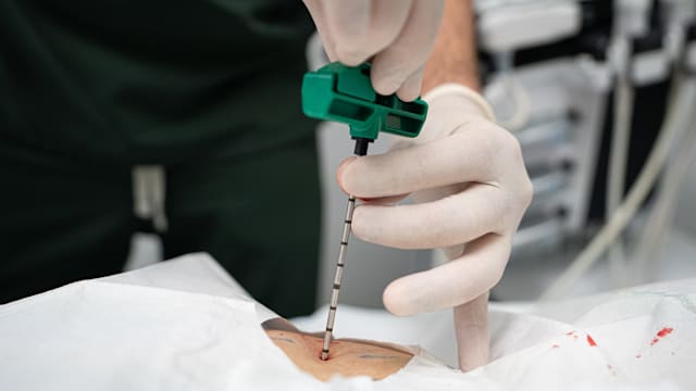 符合资格骨髓移植患者 明年起可享干细胞采集全额补贴