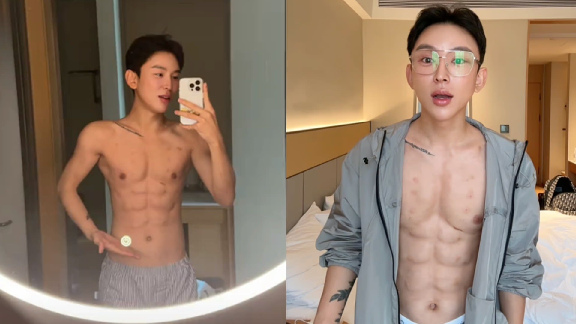 Man Spends S$728K on Injections to Get 'Abs' - 8days