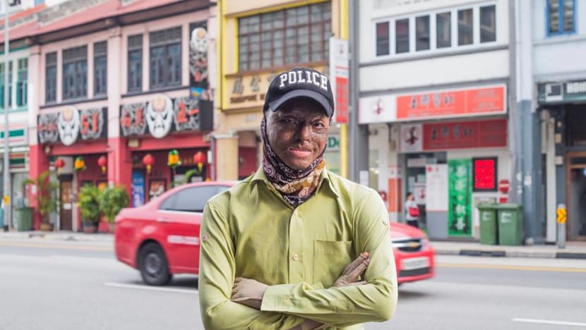 Landscaping firm and director charged for accident in which worker was severely burnt