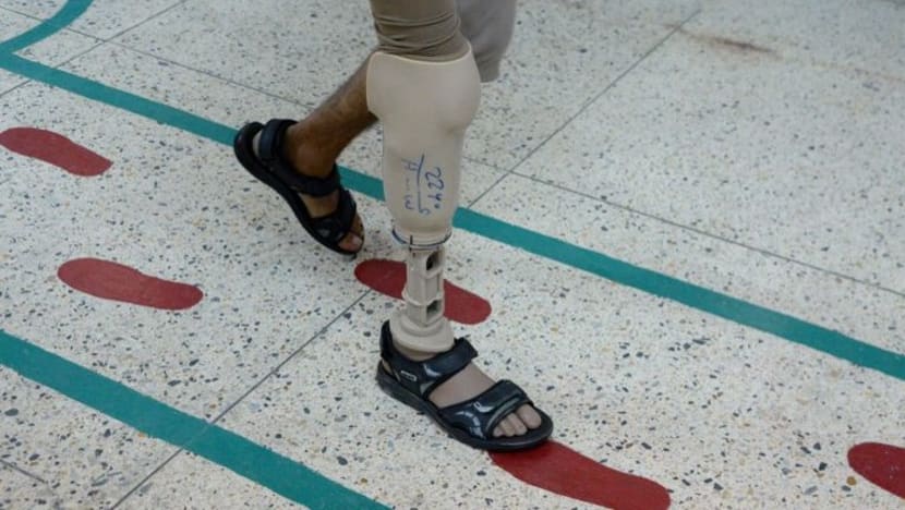 #BeliaSG: Kehilangan Kaki