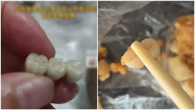 香肠烧卖吃出假牙？中国两起食品安全事件引关注