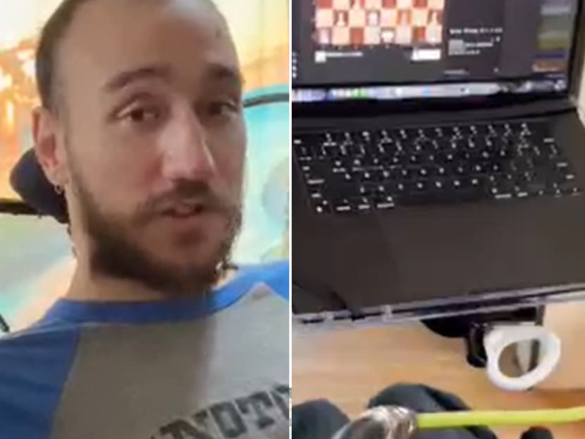 Noland Arbaugh, the 29-year-old patient who was paralysed below the shoulder after a diving accident, was playing chess on his laptop and moving the cursor using the Neuralink device.