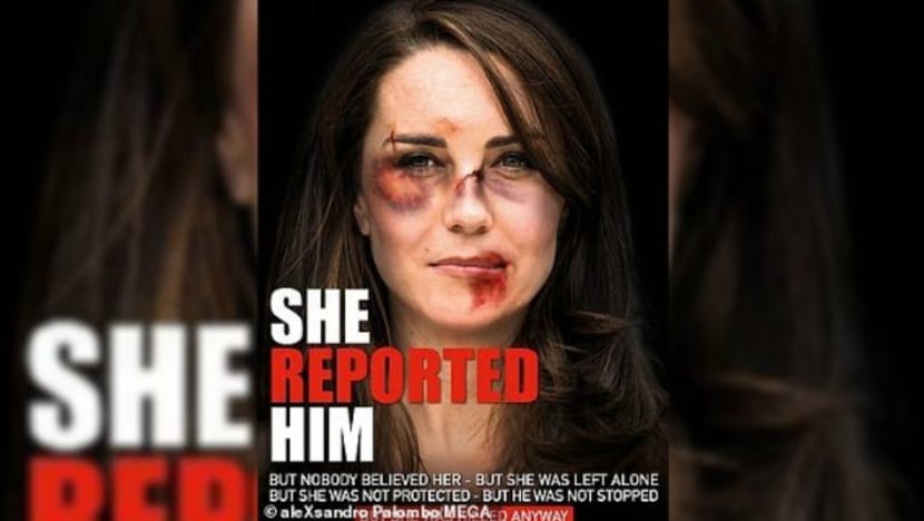 Wajah Kate Middleton 'lebam', penuh luka cetus kemarahan ramai