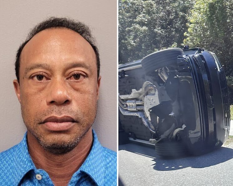 Tiger Woods says he is stepping away for treatment after DUI arrest