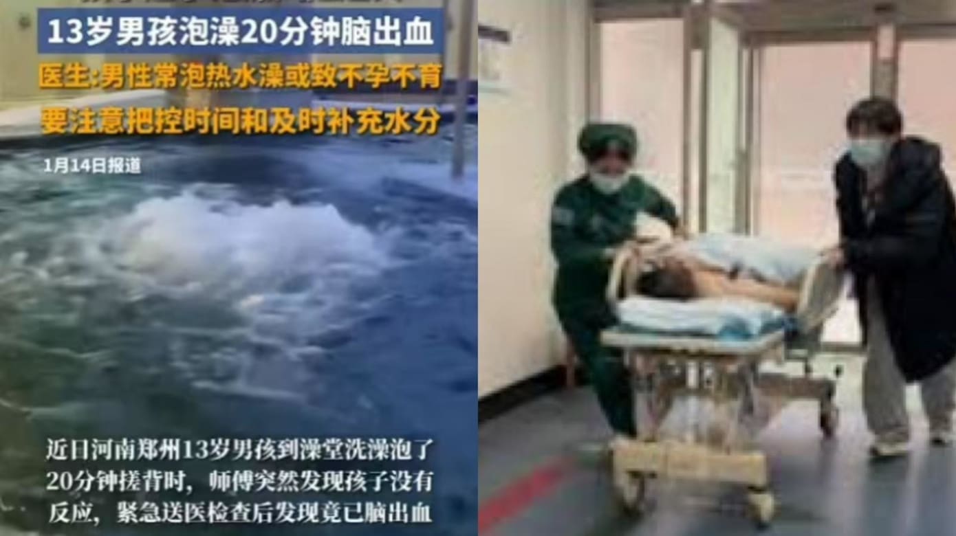 中国13岁男孩泡澡20分钟 突发脑出血入院抢救