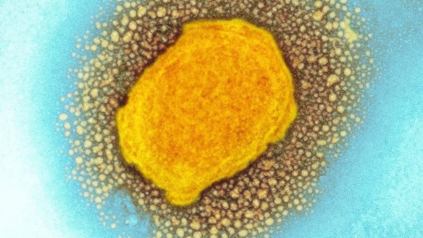 Sepanyol beli vaksin cacar monyet sedang jumlah kes cecah 55