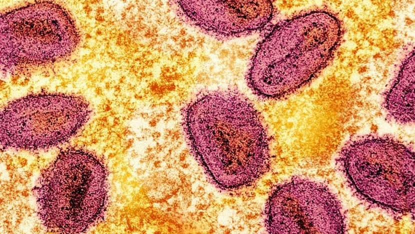 SG sahkan 2 kes mpox jangkitan tempatan; risiko terhadap orang awam adalah rendah