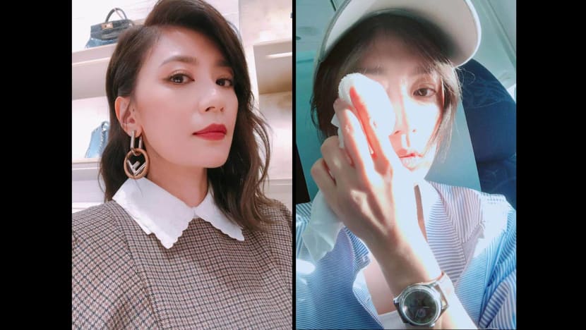 Alyssa Chia comes down with a case of viral conjunctivitis