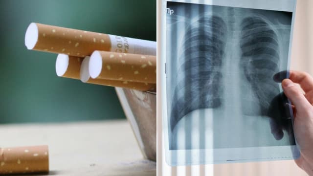 不烟不酒仍可能罹患肺腺癌　诊断后3个月属治疗黄金期