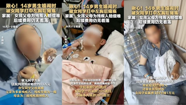 课间打闹被女同学拳击胸部 山东14岁男生瘫痪