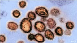 Related article image