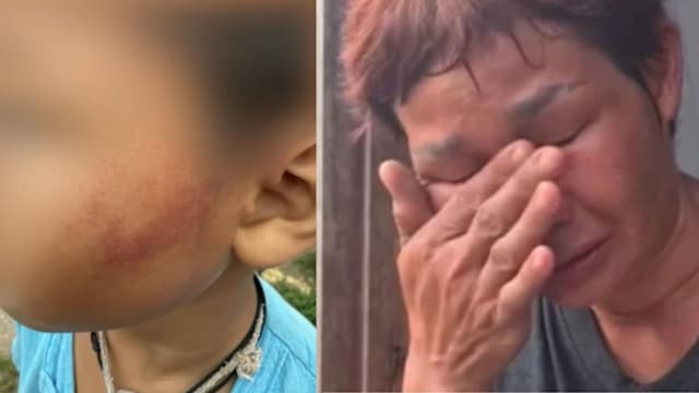 泰国男童没钱吃午餐  偷吃老师糖果被掌掴至脸肿