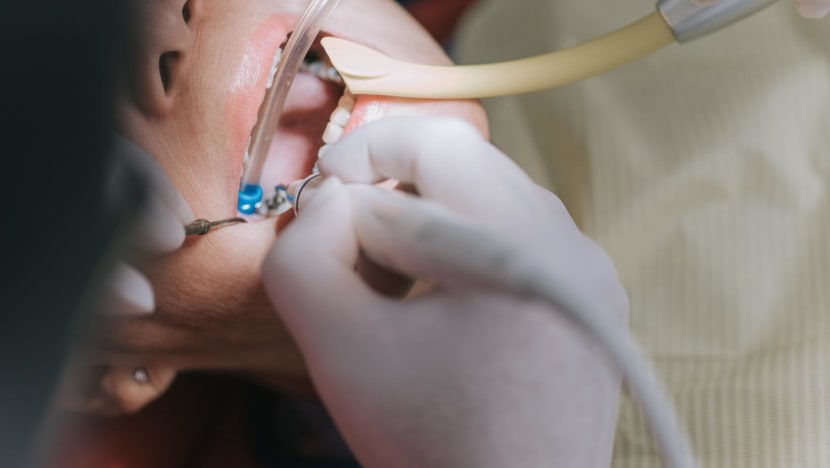 Why are root canal treatments so expensive, and what options do you have if you need one? Why are root canal treatments so expensive, and what options do you have if you need one?