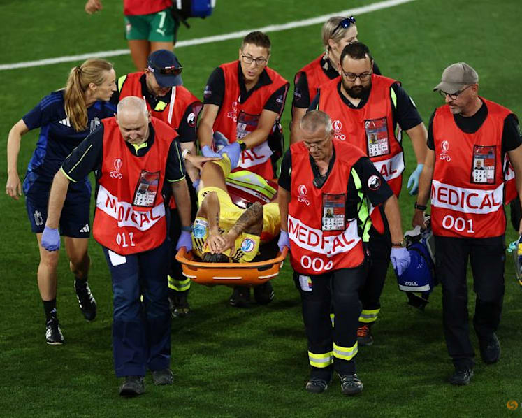 Three concussions may impact attention span in women footballers, study shows