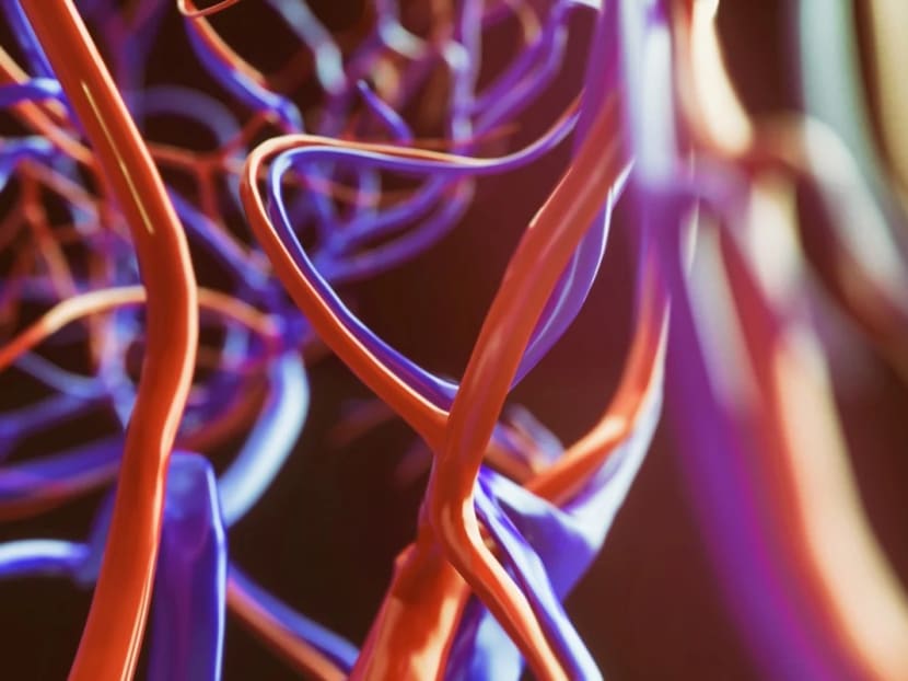 “This virus does not only attack the lungs, it attacks the vessels everywhere,” said Dr Frank Ruschitzka, an author of the paper from University Hospital Zurich.