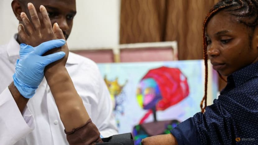 Nigerian firm develops bionic arms for amputees