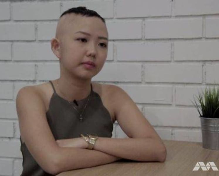 ‘It’s not just hair loss’: One woman's triumph over alopecia areata