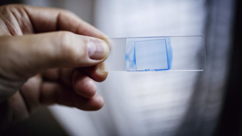 Explainer: What you need to know about super fungus Candida auris