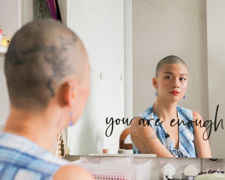 The 29-year-old who spent 12 years grappling with a hair-pulling disorder and finally shaved it all off