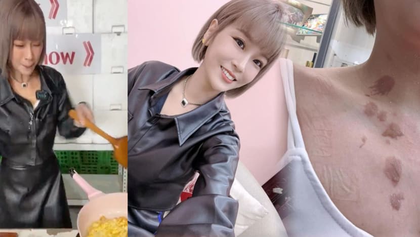 Taiwanese Live Streamer Suffers Burns After Hot Oil Splatters On Her During Cooking Demo Taiwanese Live Streamer Suffers Burns After Hot Oil Splatters On Her During Cooking Demo