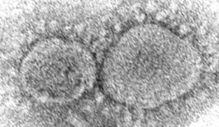 CIA says COVID-19 'more likely' to have leaked from lab