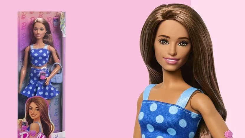 Mattel keluarkan patung Barbie pertama dengan kencing manis Jenis 1