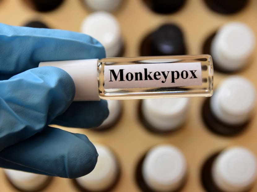 A total of 45 close contacts were identified through contact tracing. 