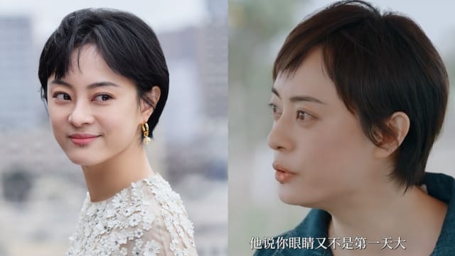 就离谱！眼睛太大竟被传是病，孙俪去医院做检查