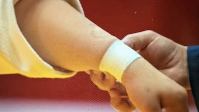 缠斗中疑咬日本对手留下牙印 中国柔道女将被判失格