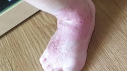 Related article image