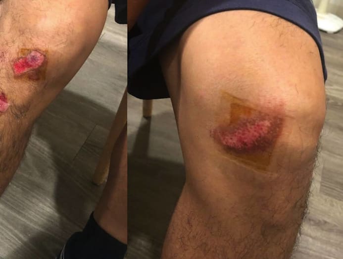 Jacky Wu Crashes Bike While Filming Variety Show; Says His Helmet