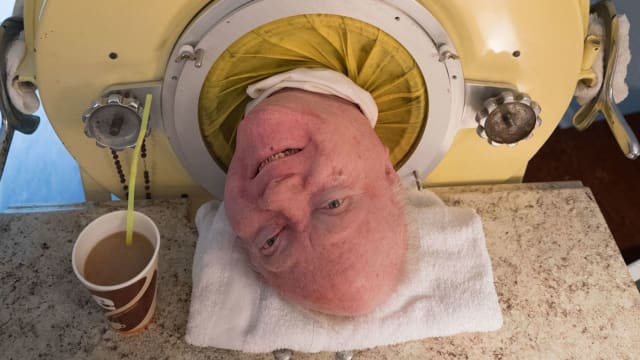 因病靠“铁肺”生活逾70年 美国传奇男子逝世