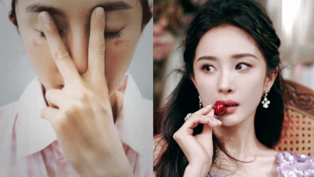 杨幂脸部被烫伤！蒸汽眼罩安全使用须知