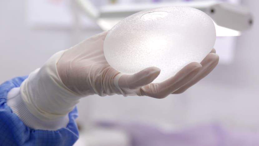 Caution urged over breast implant use after S’pore sees first case of implant-linked cancer