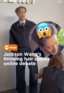 What happened to his hair? #8dayssgAsianEnt #8dayssg #jacksonwang #ThinningHair #hairtok 