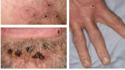 Related article image