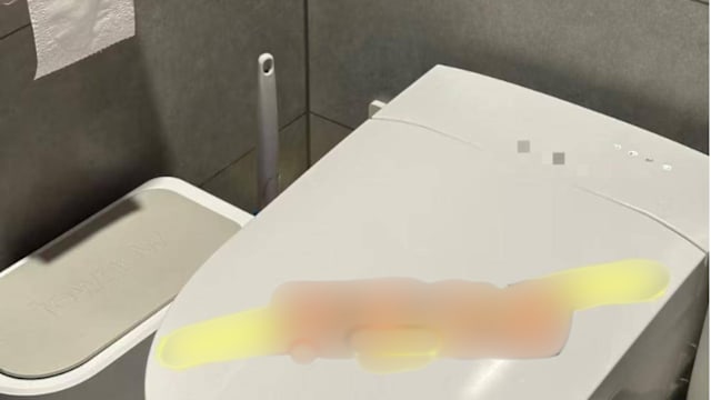 智能马桶竟喷出冒烟热水 女子阴部二级烫伤