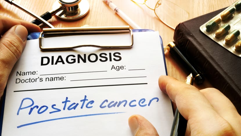 New NUH procedure reduces side effects for prostate cancer patients undergoing radiation treatment New NUH procedure reduces side effects for prostate cancer patients undergoing radiation treatment