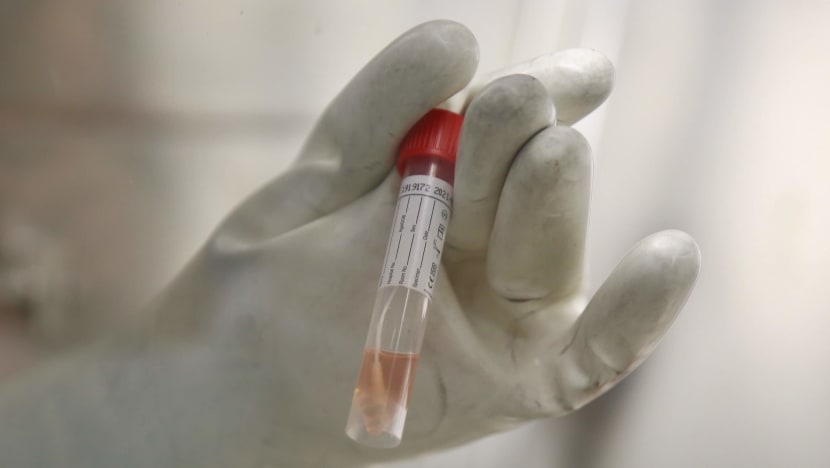 New Covid-19 test kit deployed at all S’pore checkpoints detects its first imported case